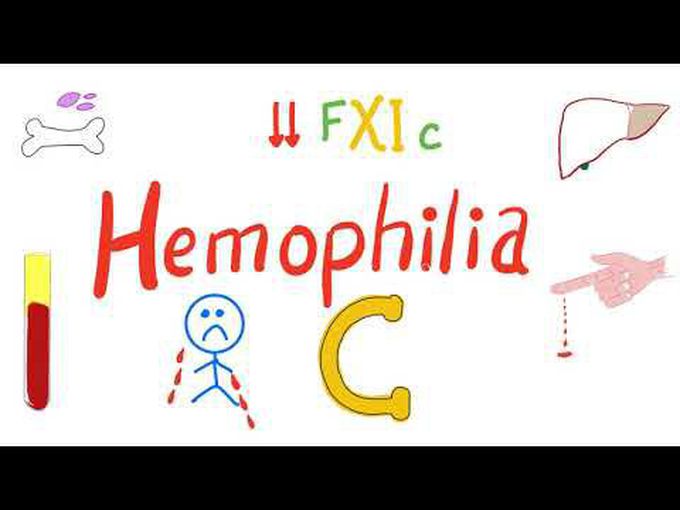 Hemophilia C