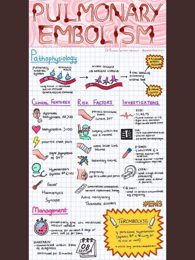 Pulmonary Embolism