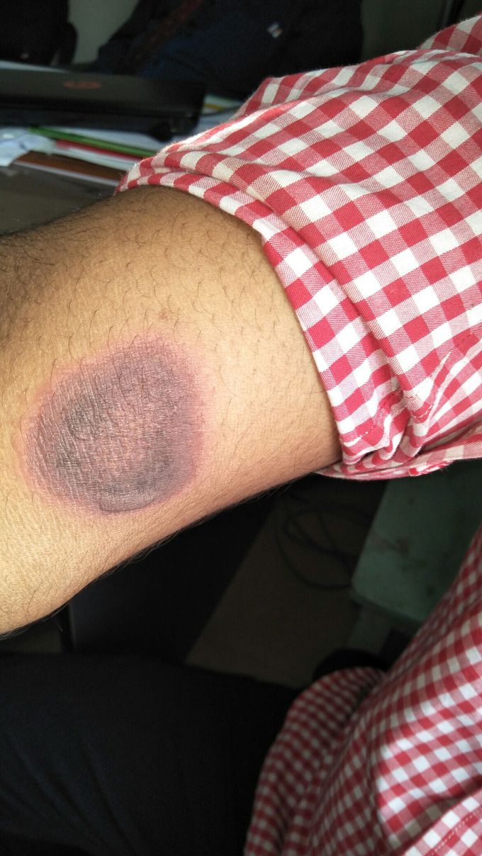 What's your Diagnosis ?