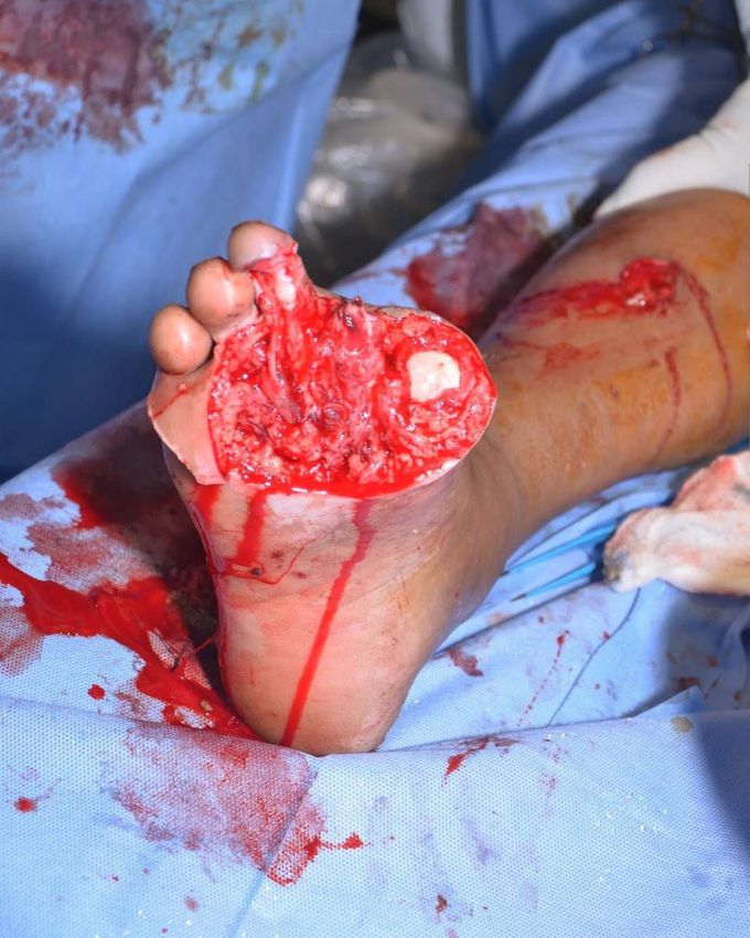 A young driver in his 30's met with a road traffic accident.