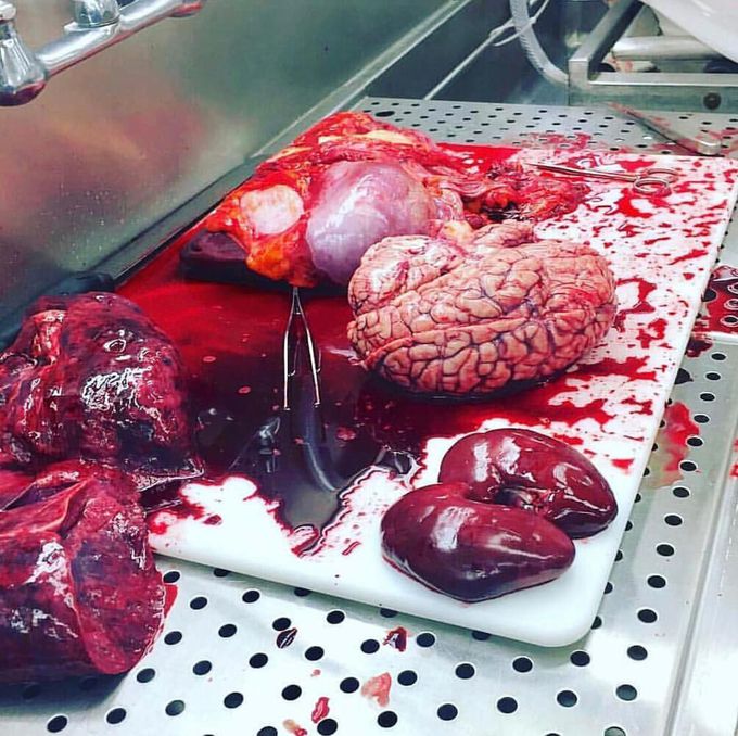 Human organs