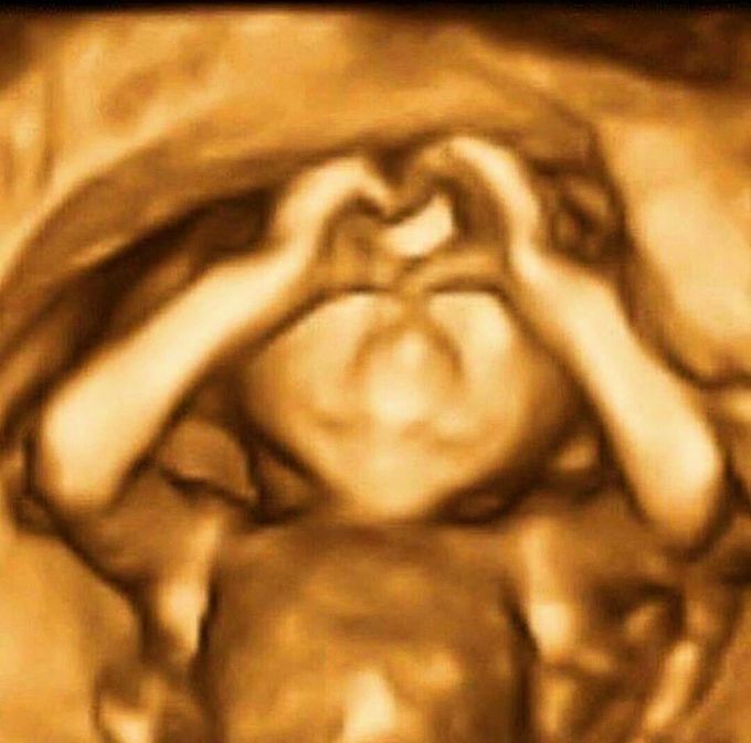 👌🏻Amazing 3D picture of a fetus‼️