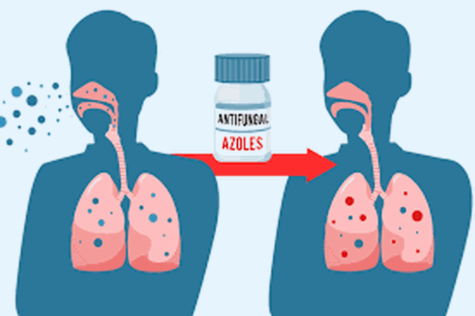 Treatment of aspergillosis