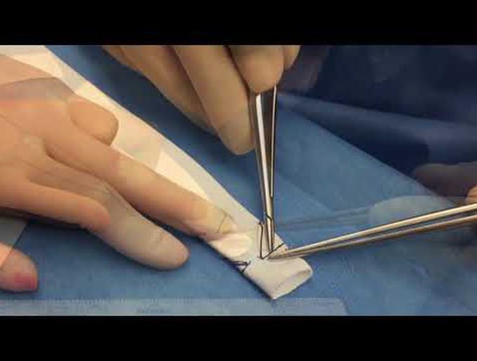 Bileaflet Polytetrafluoroethylene Conduits for Right Ventricular Outflow Tract Reconstruction