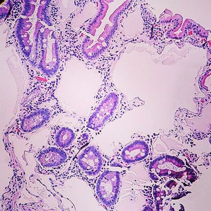 Pathology GI