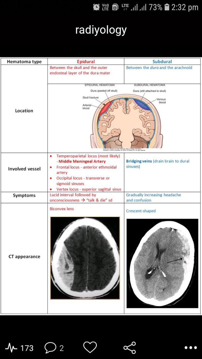 CT brain