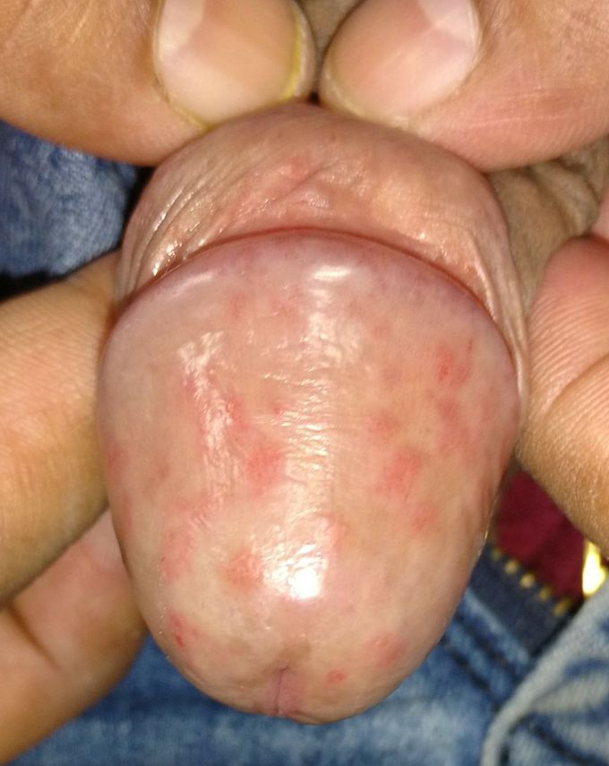What is the diagnosis?