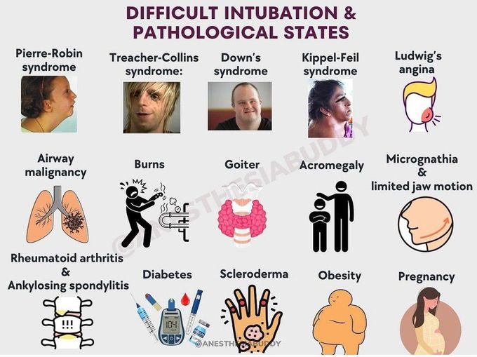 Difficult Intubation and Pathological States
