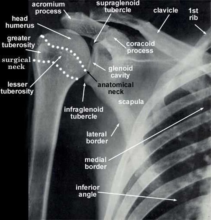 Xray shoulder