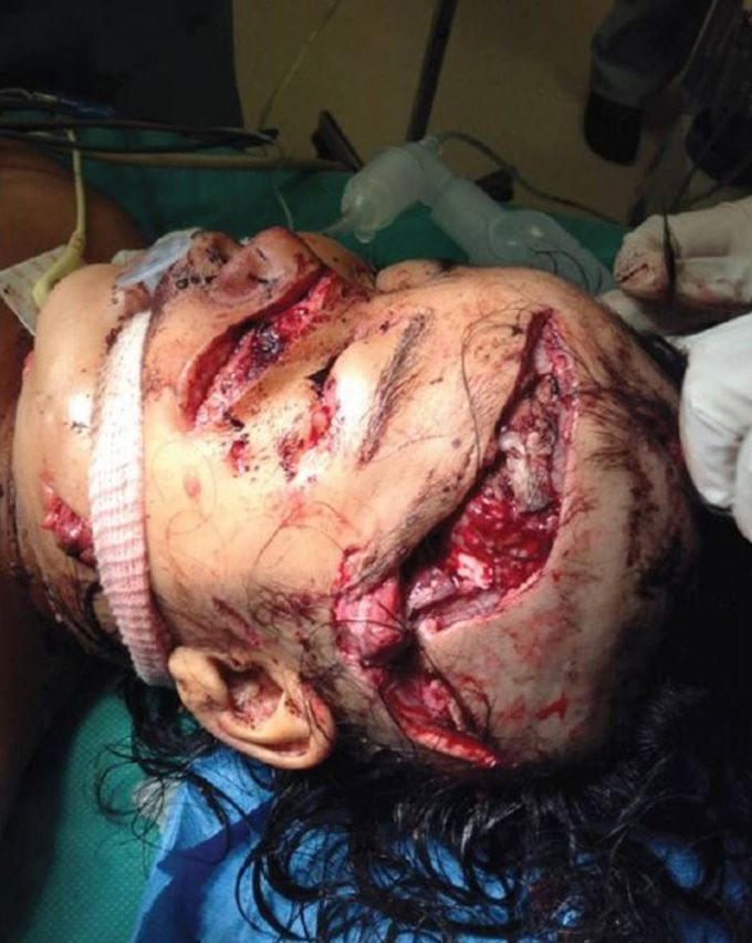 A girl presented to the emergency department after being attacked by a JAGUAR!