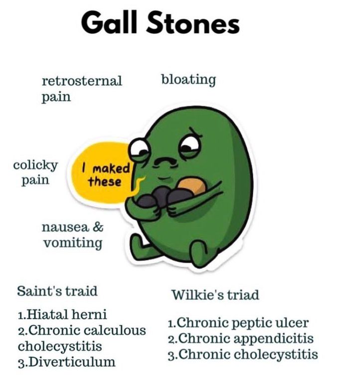 Gallstones