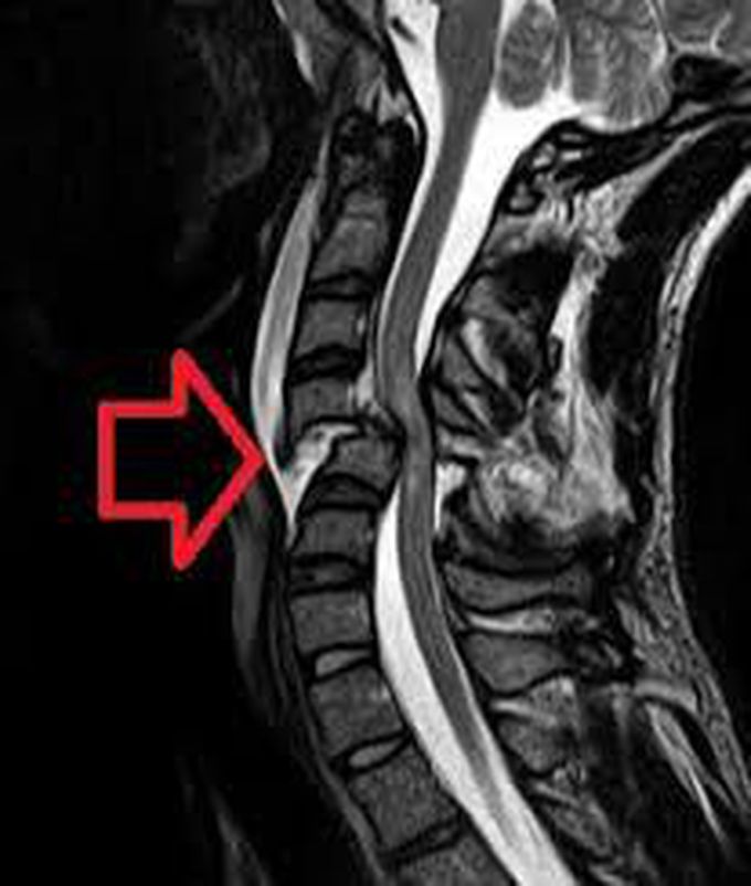 Causes of neurogenic shock