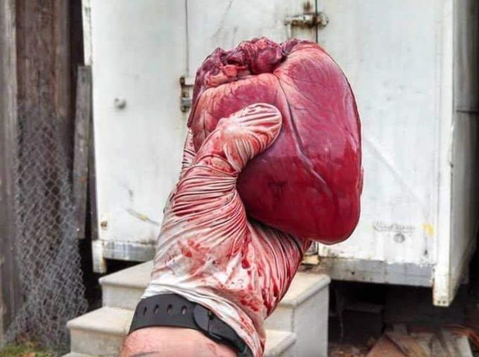 Human heart