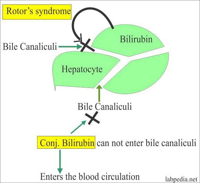 Rotors syndrome