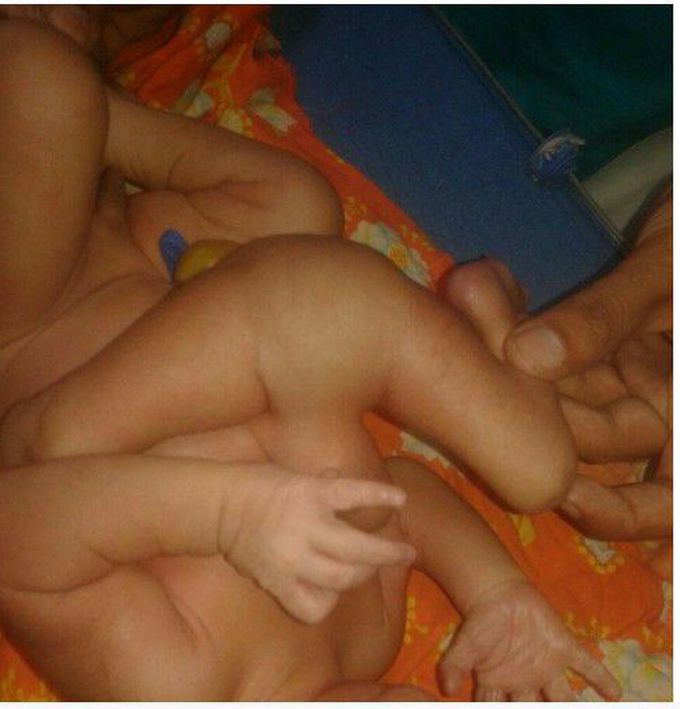 Spot the DIAGNOSIS??