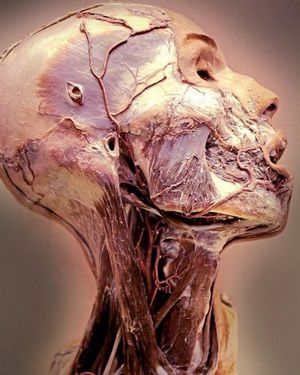 Anatomical model portraying various anatomical structures of the head and neck