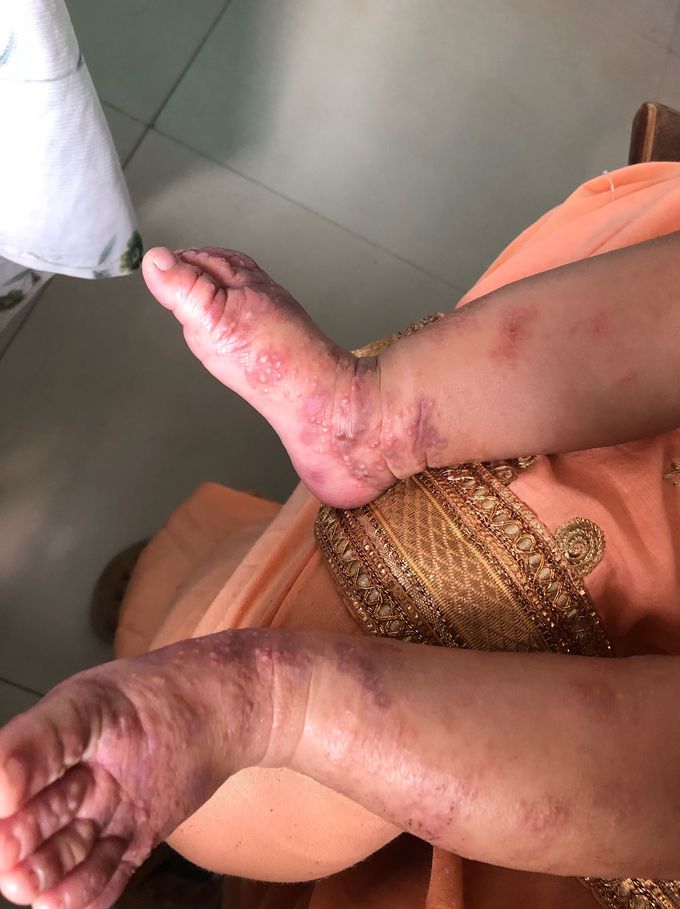 Spot diagnosis