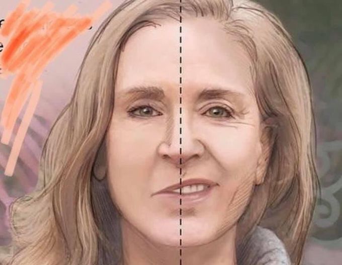 This is a hard one:
Which side of the face is paralyzed? Left or right?