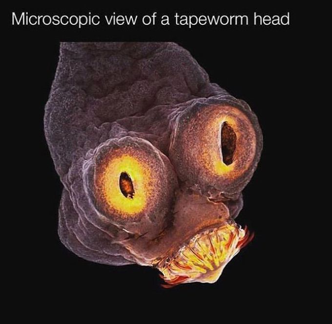 Tapeworm