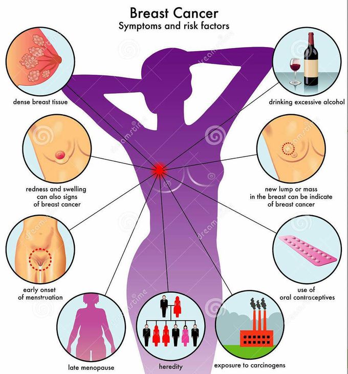 Symptoms of Dense Breast