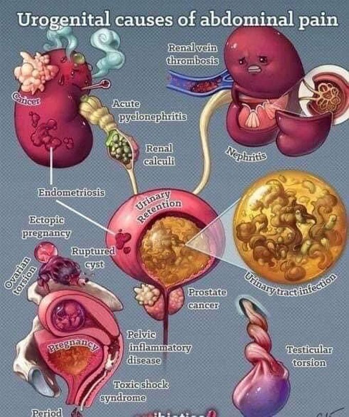 Urogenital