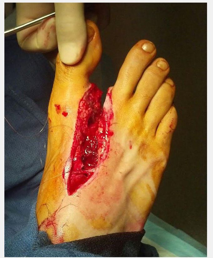 Foot 👣