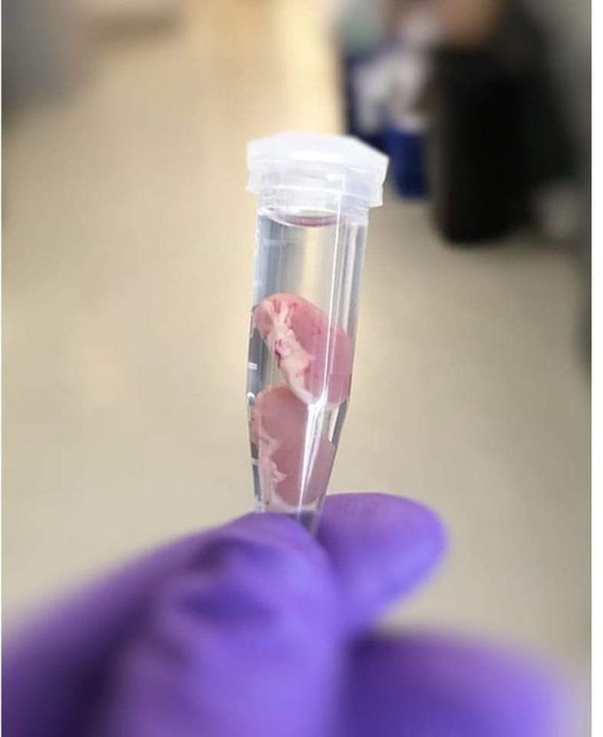 Rat kidney. Humans have about 1 million nephrons per kidney, whereas mice have only 30-35,000 nephrons per kidney. Nephron is the structural and functional unit of the kidney.