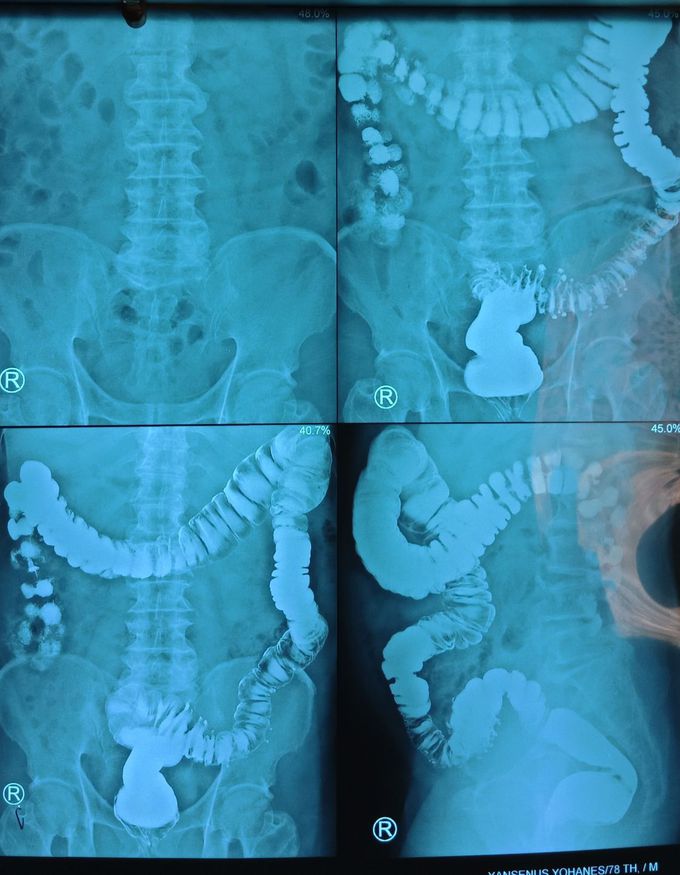 whats your diagnosis?