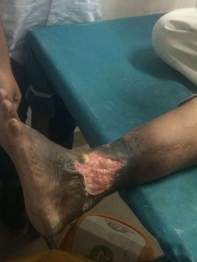 Diagnosis ?