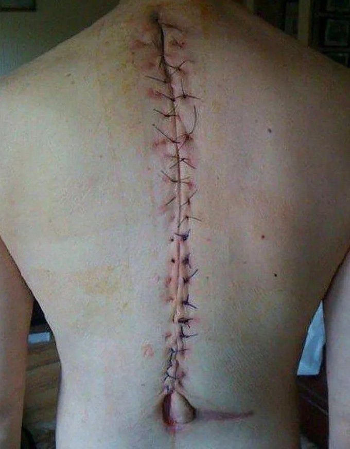 orthopedic surgery