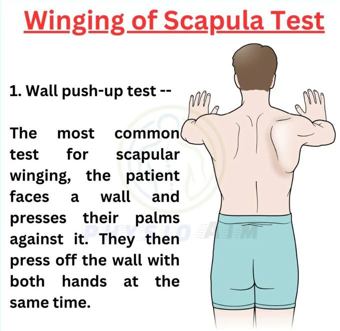 Winging of Scapula I