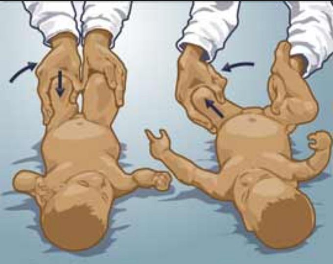 What's the name of this maneuver??