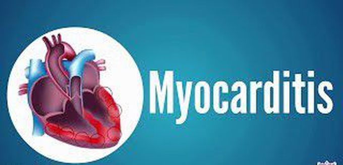 Treatment for Myocarditis