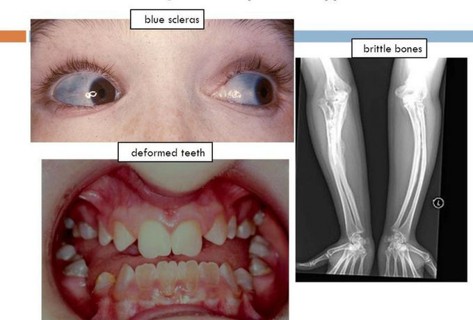 In which disease we see these signs?!