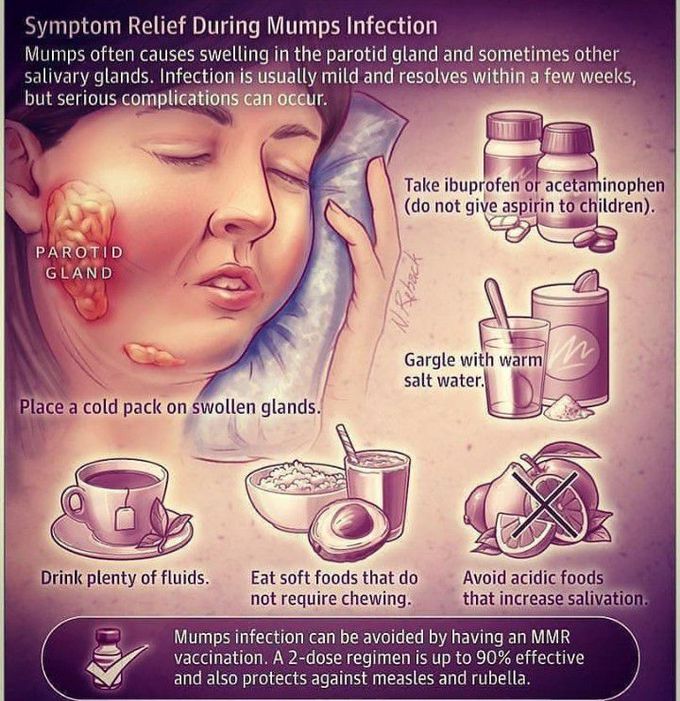 Symptom relief during mumps infection