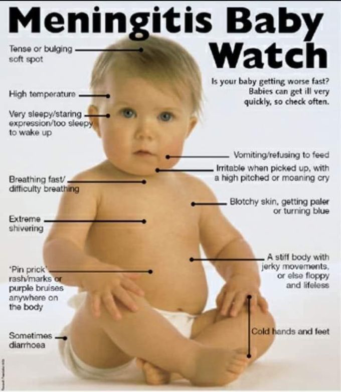 Baby watch.. Meningitis