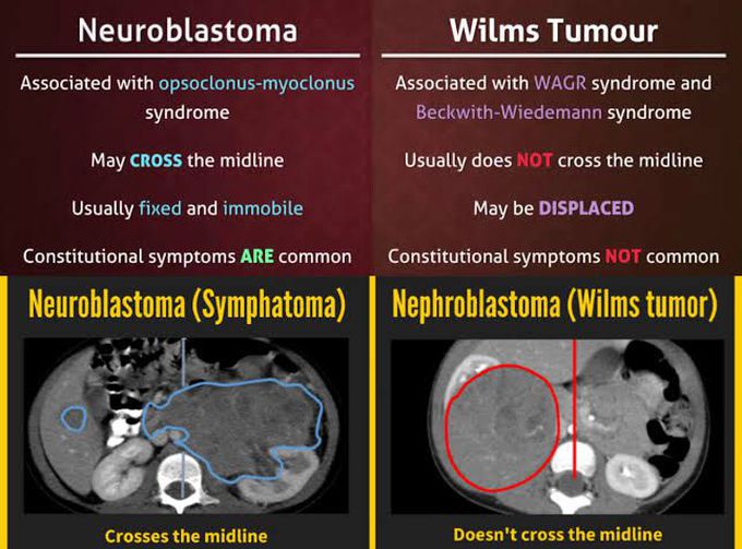 Neuroblastoma and Wilms Tumor