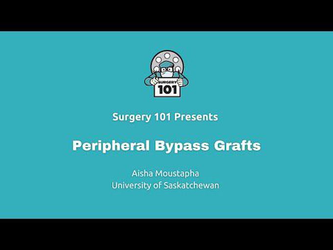 Peripheral Bypass Grafts-Animation