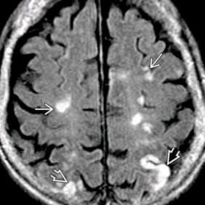 What is your diagnosis?