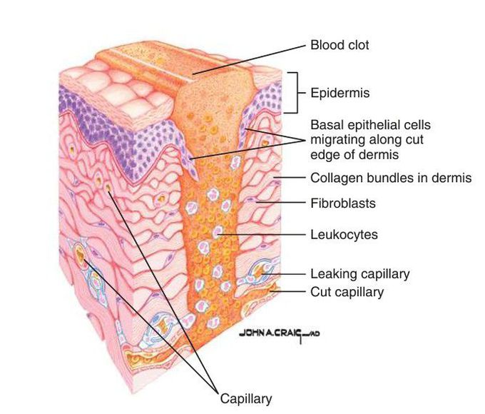 Inflammatory (lag) stage of wound repair.