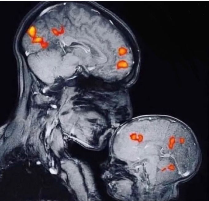 This is the world's first ever magnetic resonance image showing a mother and child's bond!!❤️