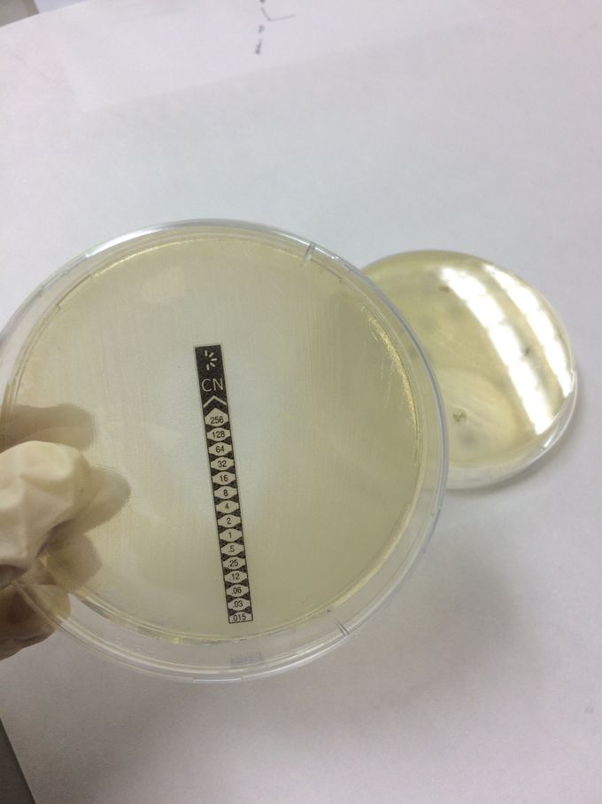 Antimicrobial Resistance