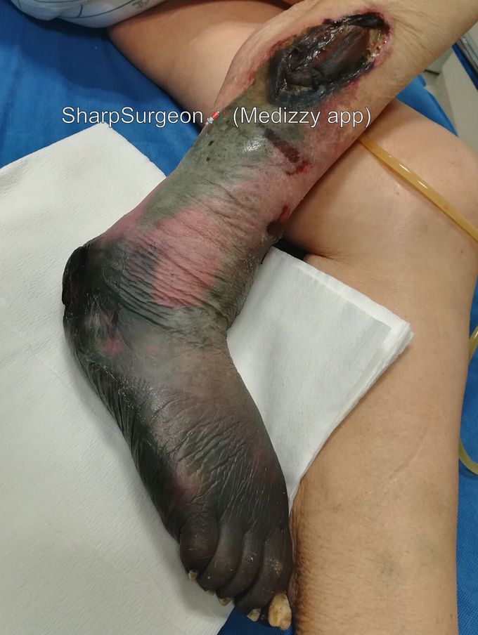 ❓What is your diagnosis❓🤔