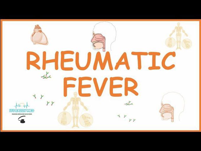Pathogenesis of Rheumatic fever-Explained