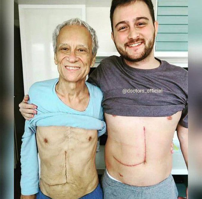 Donated 60% of his liver to his father😍😍