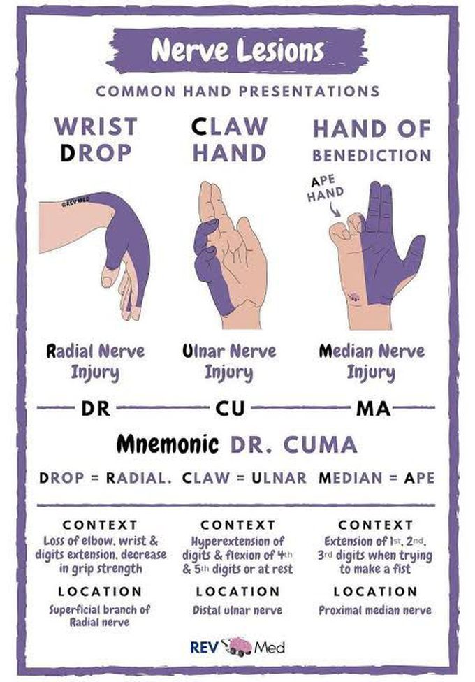 Nerve lesions of hand