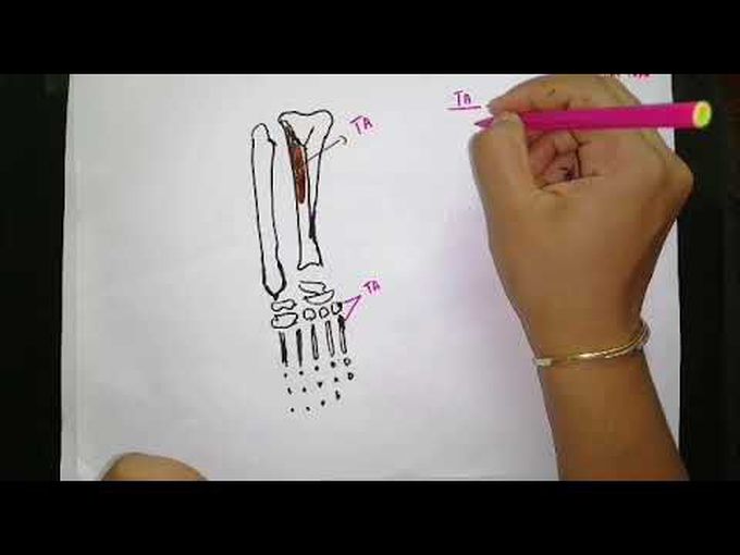 Muscles of the Anterior Compartment of the Leg