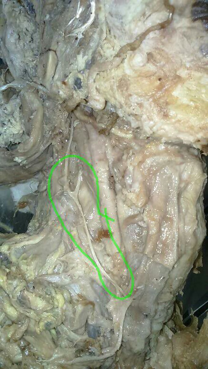 Structure???