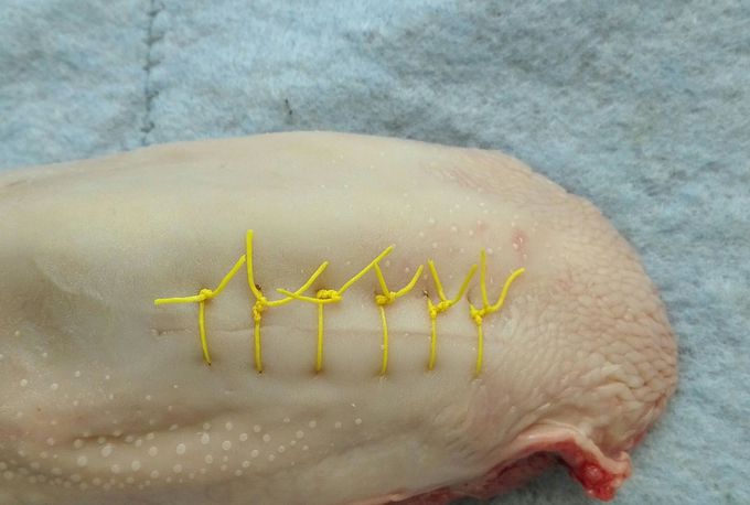 Typical surgery suture