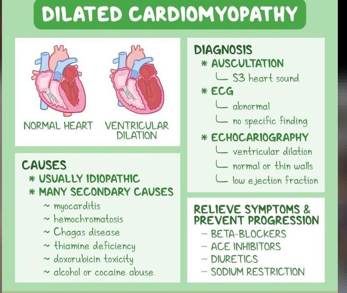 Dilated Cardiomyopathy - MEDizzy